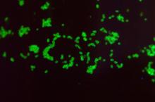 numerous Neisseria gonorrhoeae diplococcal bacteria